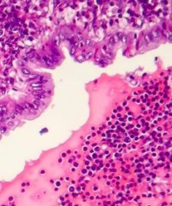 Гистология/ Патоморфология