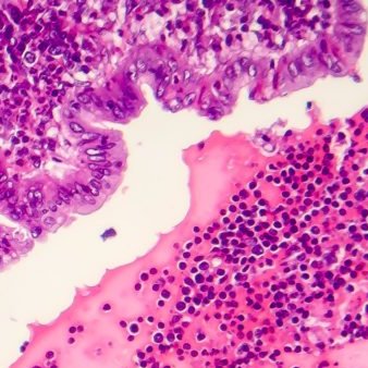 Гистология/ Патоморфология